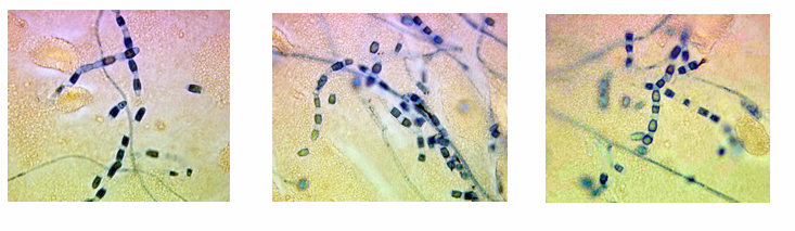 <p>-exists as a mycelia</p><p>-when contacted, these release arthroconidia (2-4 microns) that are highly resistant to harsh environmental conditions</p><p>-aerosolize and are inhaled into the terminal bronchioles</p>