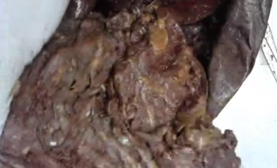 <p>Covers intestines</p>