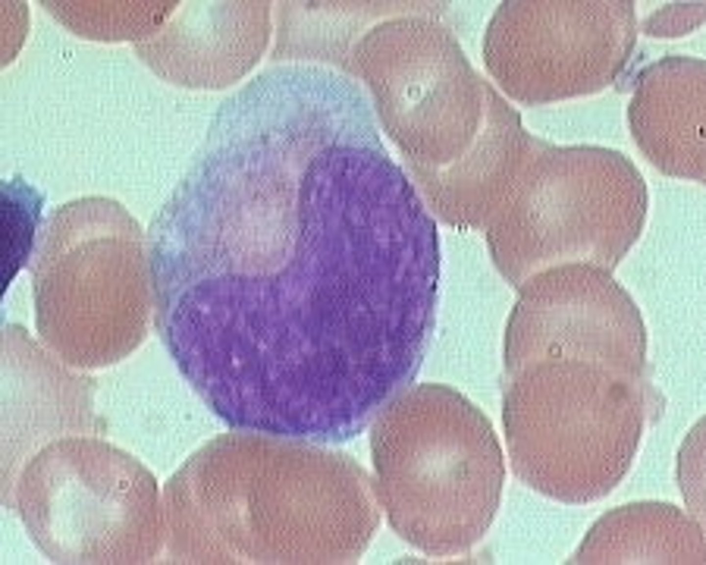 <p>metamyelocyte</p>