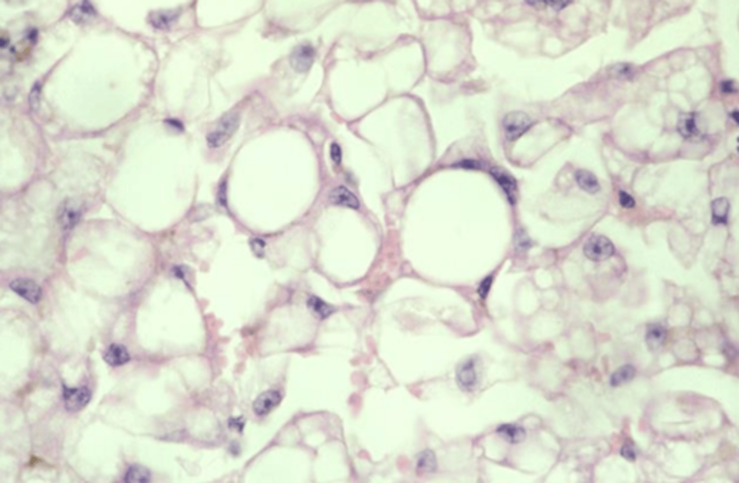 <p>glycogen or lipid inclusions?</p>