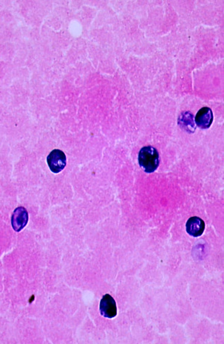 <p>Pneumocystis carinii produces round to oval cysts that stain blue with Gram-Weigert.</p>