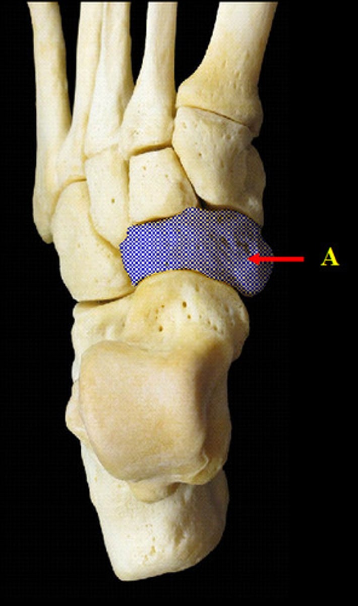 <p>Name the bone.</p>