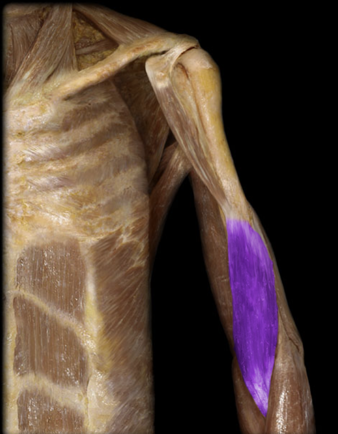 <p>What muscle is this?</p>