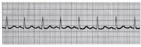 <p>What kind of rhythm is this? </p>