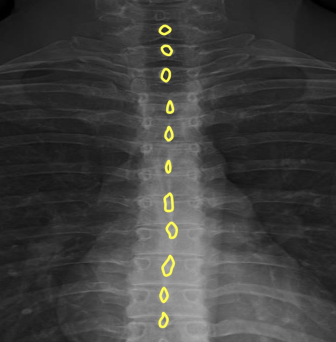 <p>What are the yellow circles?</p>