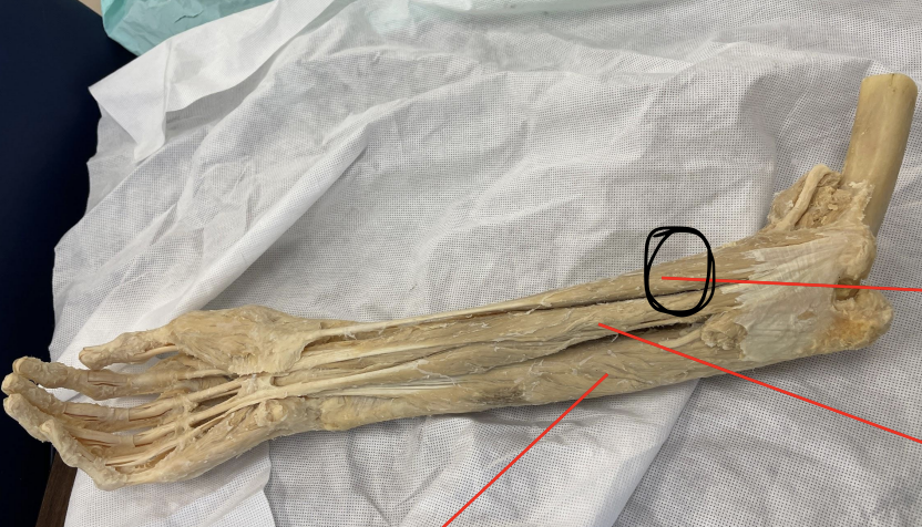 <p>identify + state origin, insertion, action, innervation of marked structure</p>