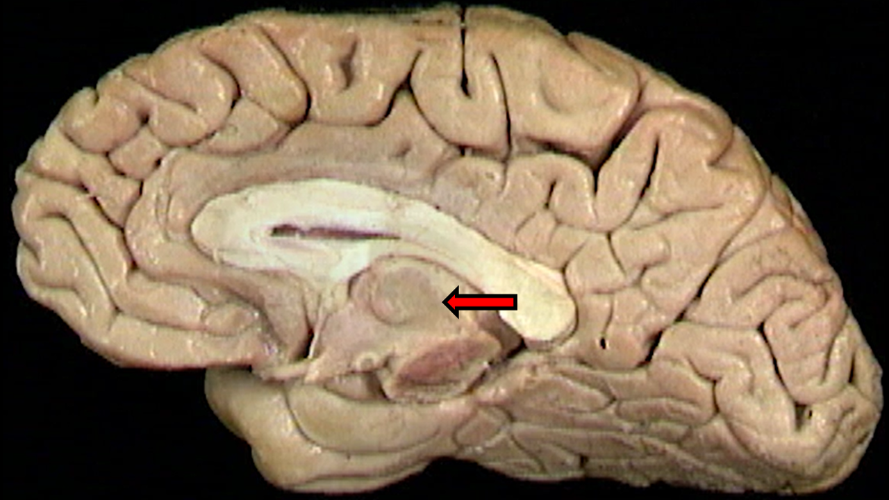term image