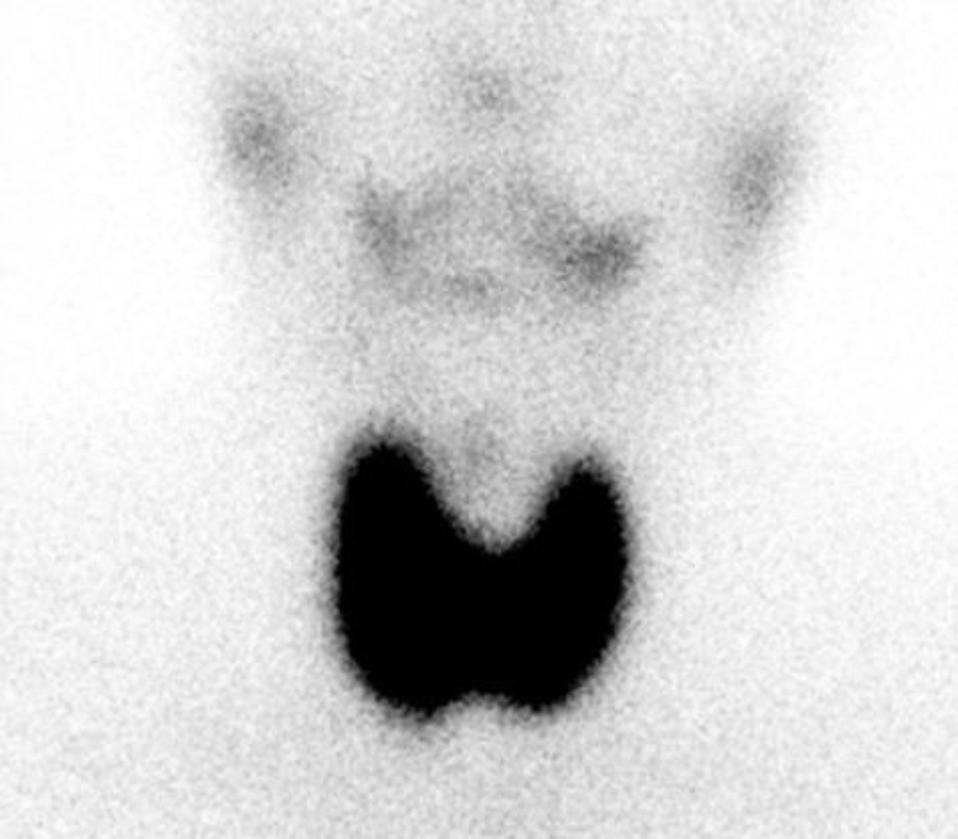 <p>radioactive isotope injected</p>