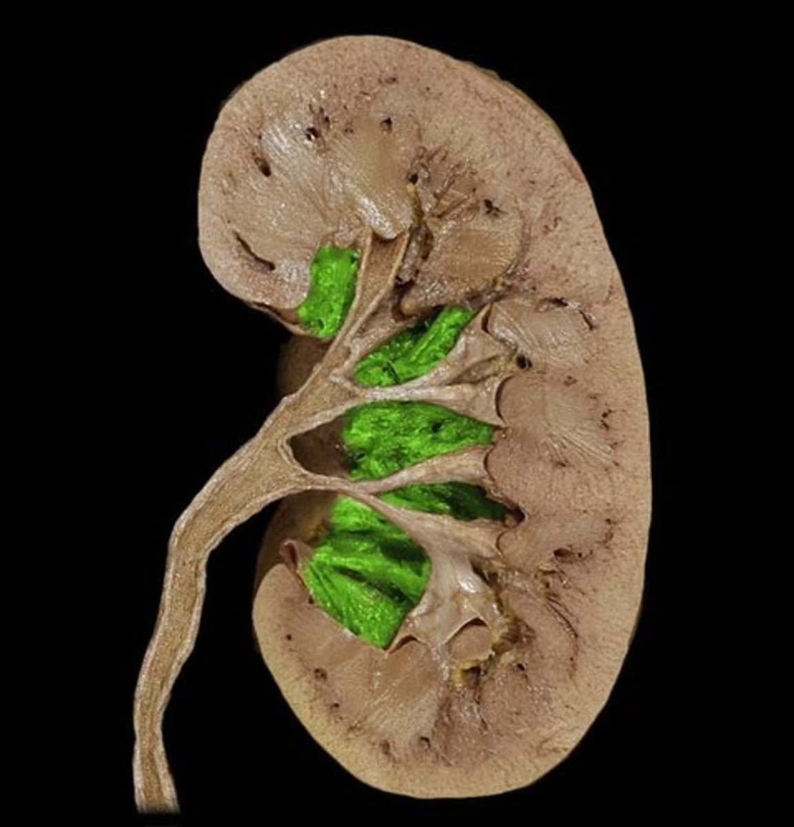 <p>• Hollow-chambered innermost part of the kidney</p>