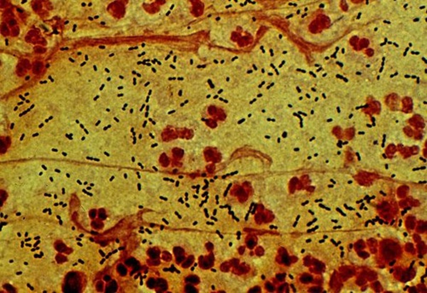 <p>To locate bacteria in blood cultures and other specimens where finding bacteria is difficult.</p>