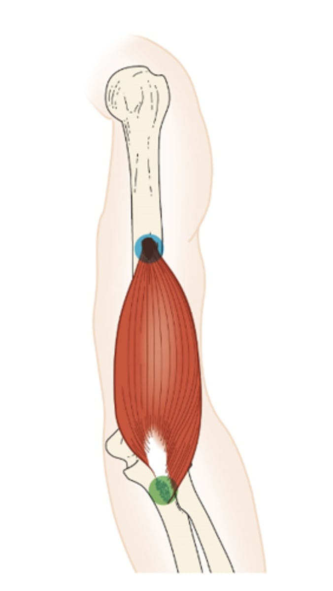 <p>What muscle is this?</p>