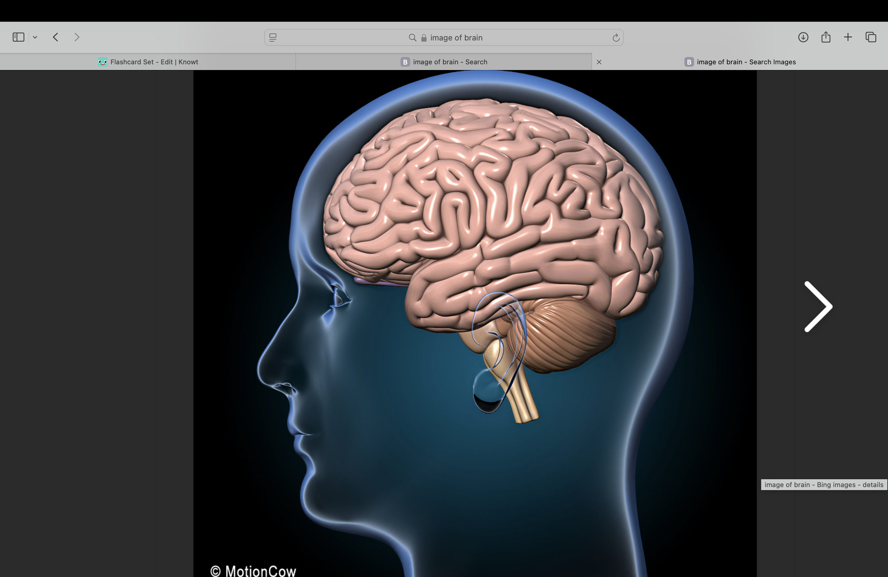 <p>Relating to the brain </p>