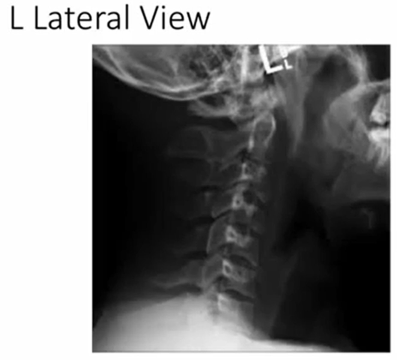 <p>perspective of the x-ray beam</p><p>(in this picture its a left view, if it was a right the person would be facing the opposite direction)</p>