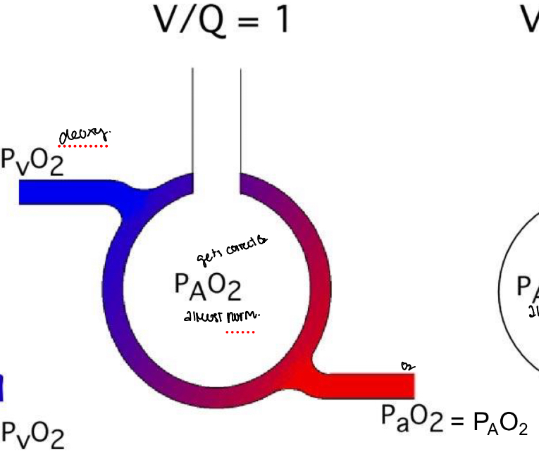 <p>The higher the V/Q ratio, the closer the outflowing blood composition</p>