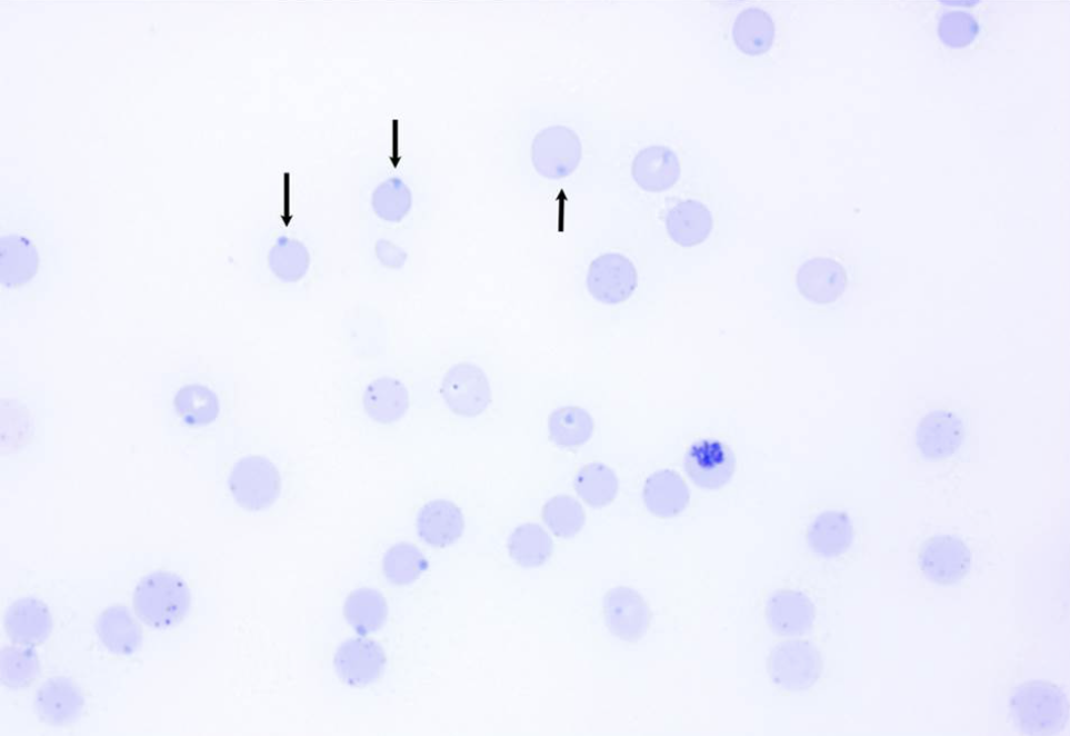 <p>The following blood film was most likely stained using</p>