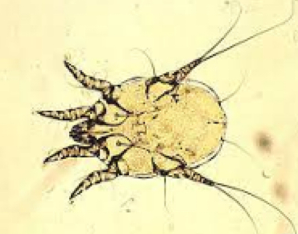 <p>What mite is this and where would you find it?</p>