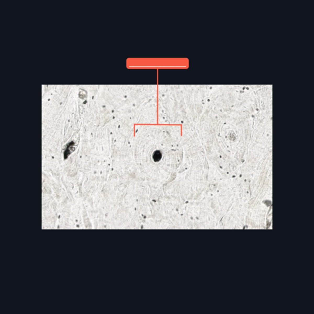 <p>This makes up the bulk of compact bone. It consists of several (4-20) bony lamellae with their associated lacunae and osteocytes</p>