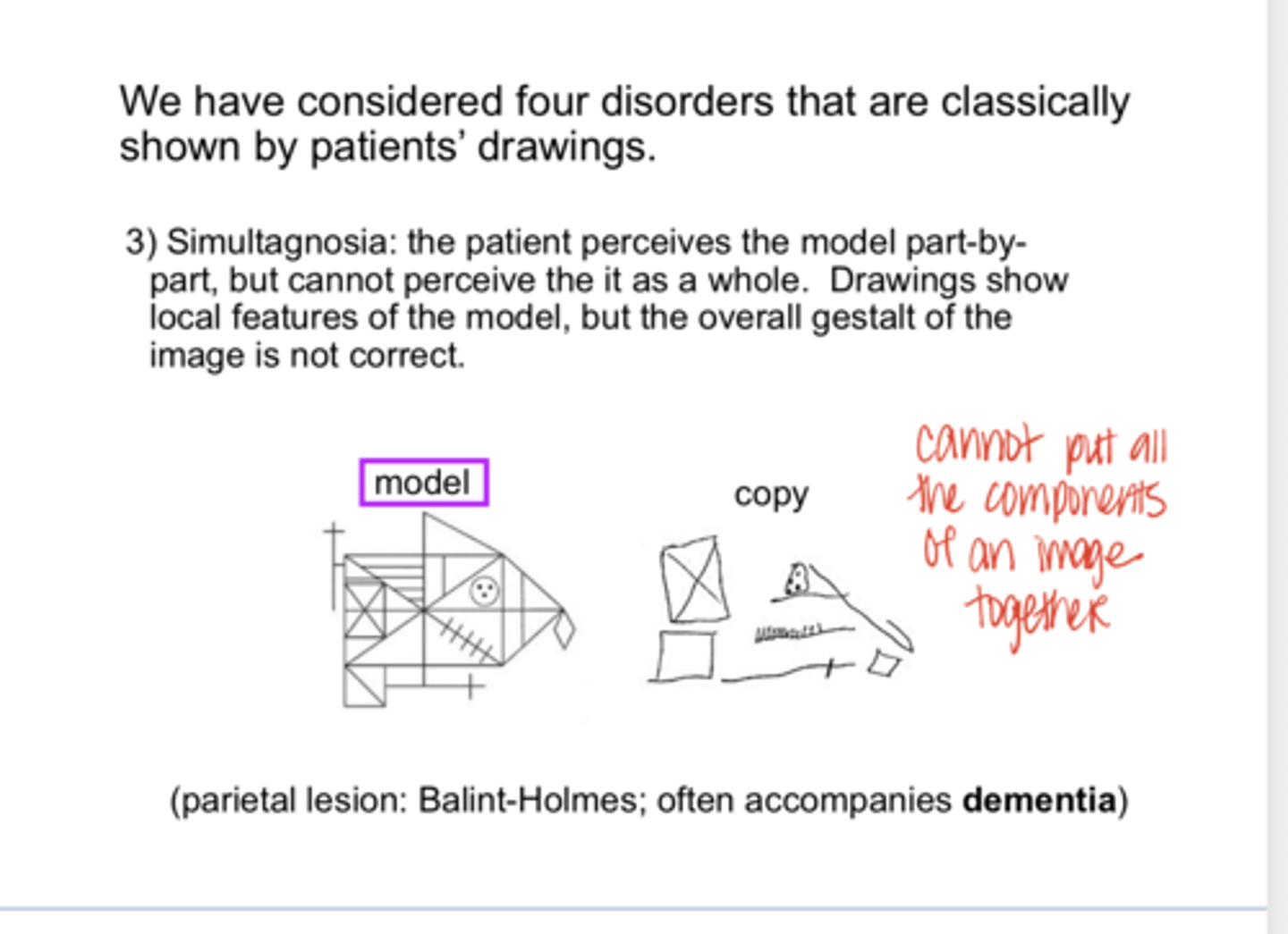 <p>REVIEW: What is simultagnosia?</p>