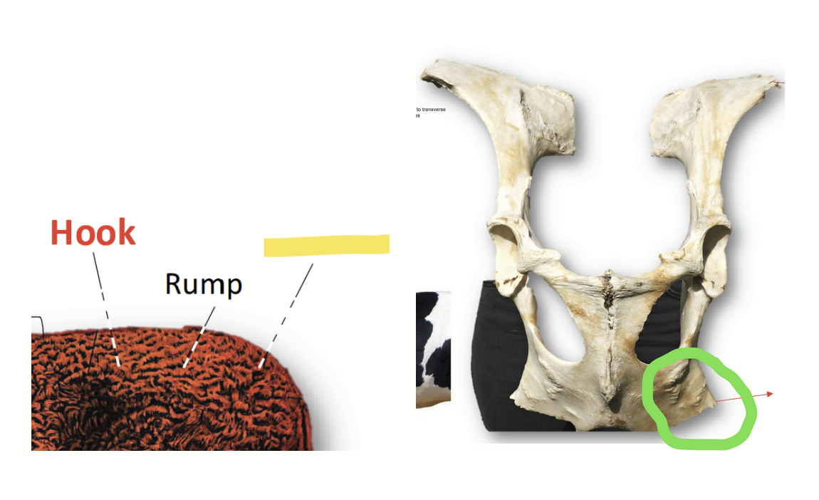 <p>Ischiatic tuberosity of the ischium. One of the three bones which make up the pelvis.</p>