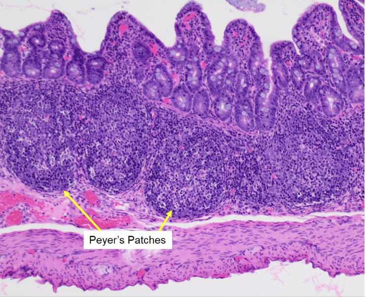 **Ileum**