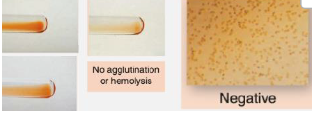 <p>Agglutination Grading</p>