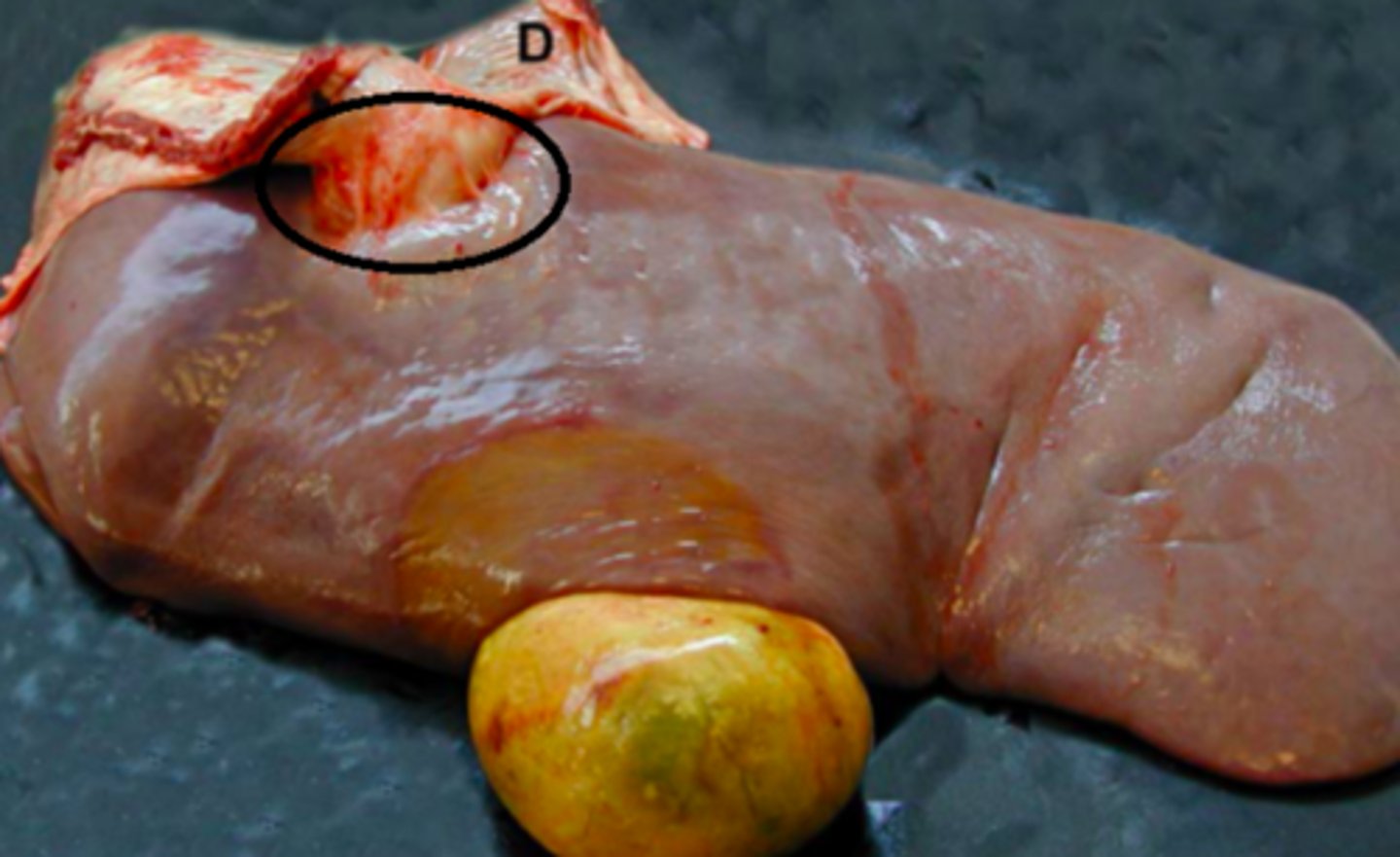 <p>Lever fra kvæg og diaphragma (d), hvad er den patoanatomiske diagnose?</p>