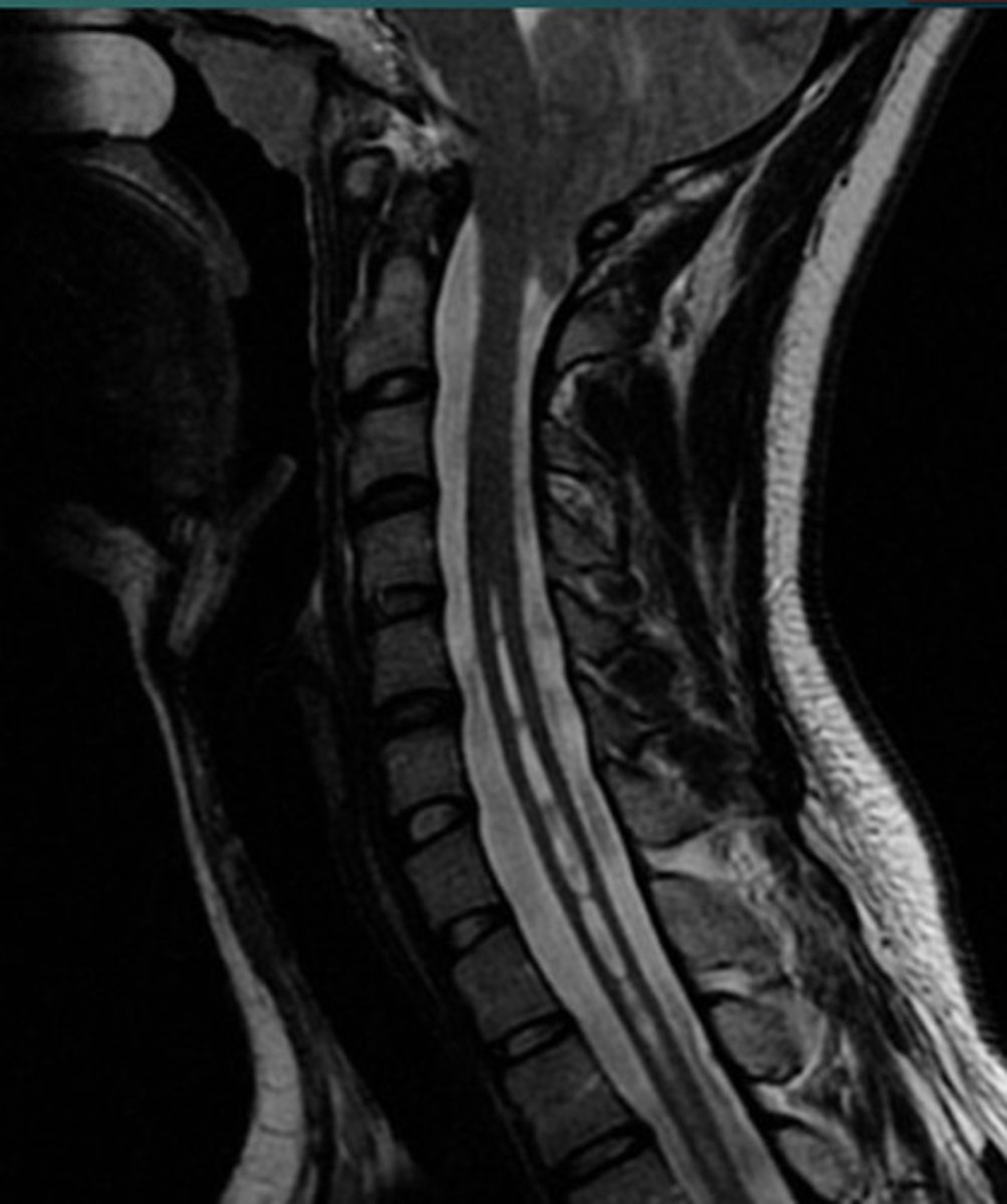 <p>What abnormality is this?</p>