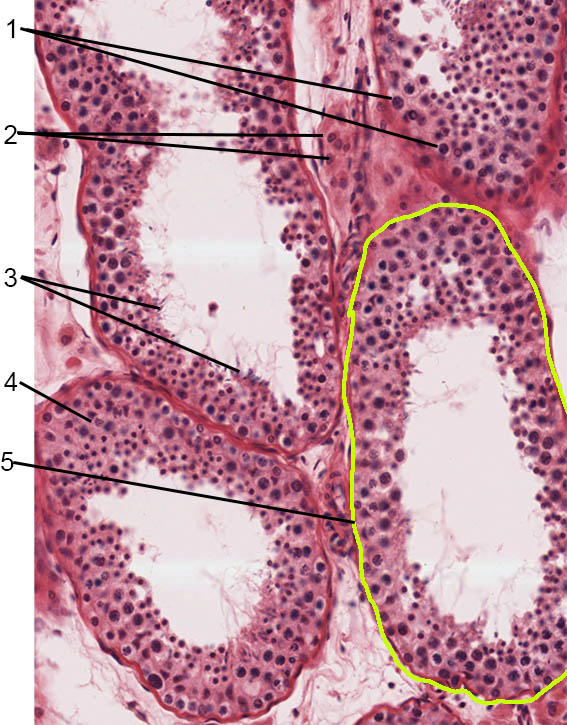 <p>what structures is this a slide of?</p>