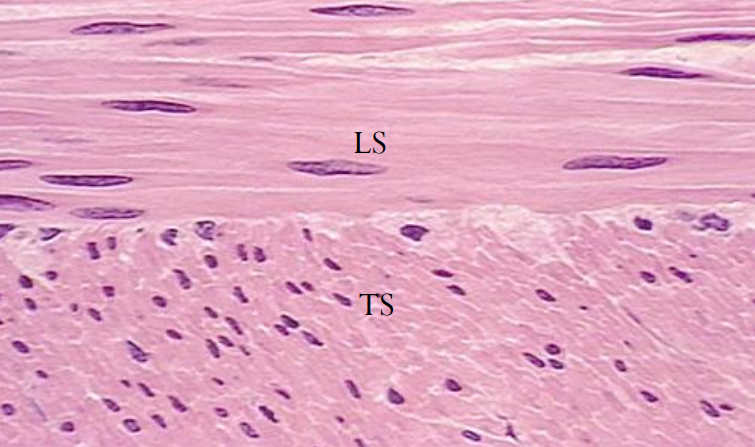 term image