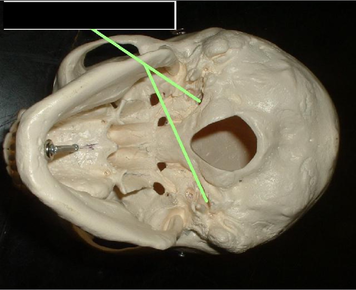 <p>left and right of the foramen magnum; peanut (in shell shaped); behind the Carotid Foramen</p>