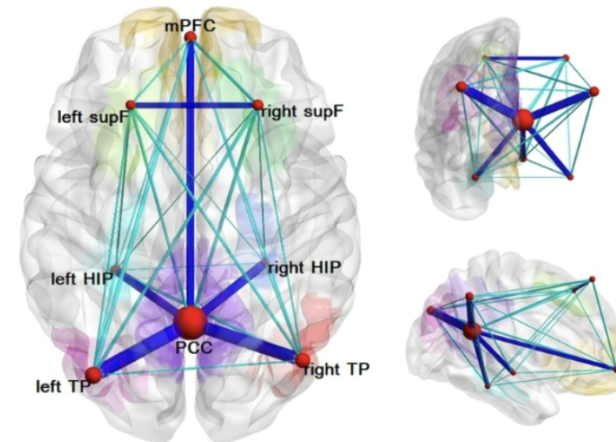 <p>Areas active when NOT actively thinking about a tasks (resting state): mPFC, left TP, right TP</p><ul><li><p>Self-referential processing (think about past)</p></li></ul><p></p>