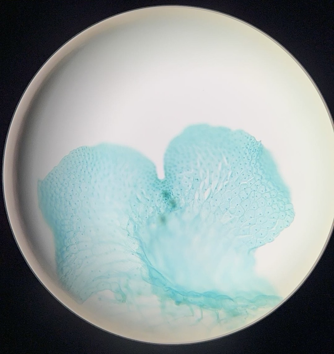 <p><span>What is this organism?</span></p>