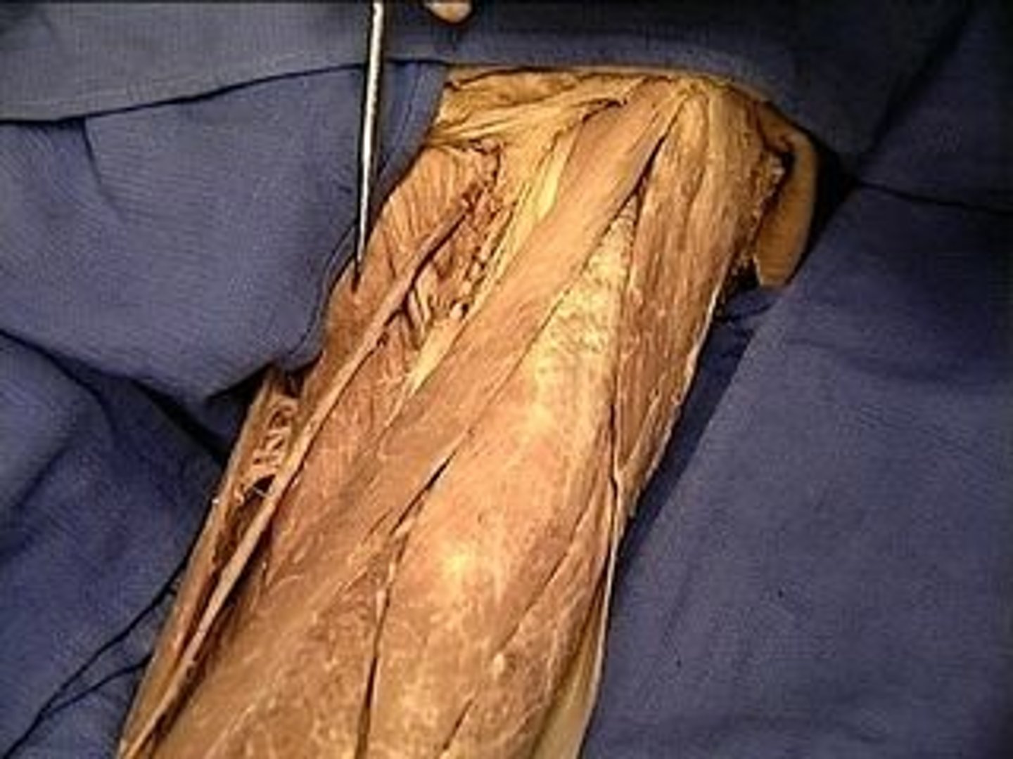 <p>Adducts and flexes thigh at the hip; assists in medial rotation</p>