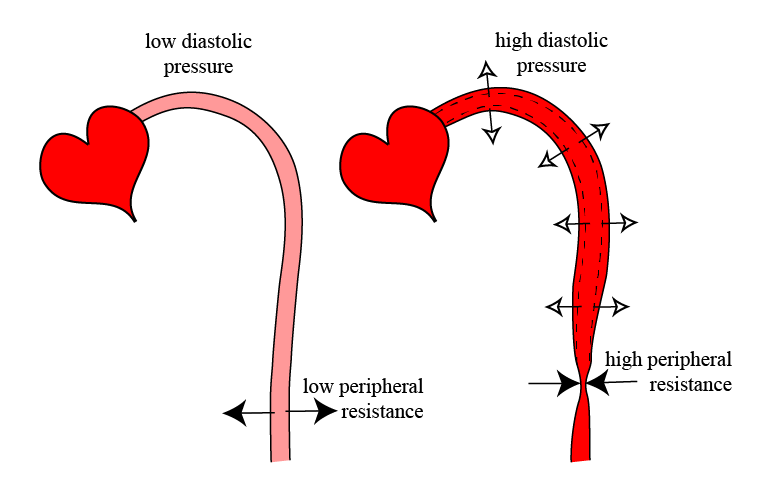 <p>Peripheral resistance results in</p>
