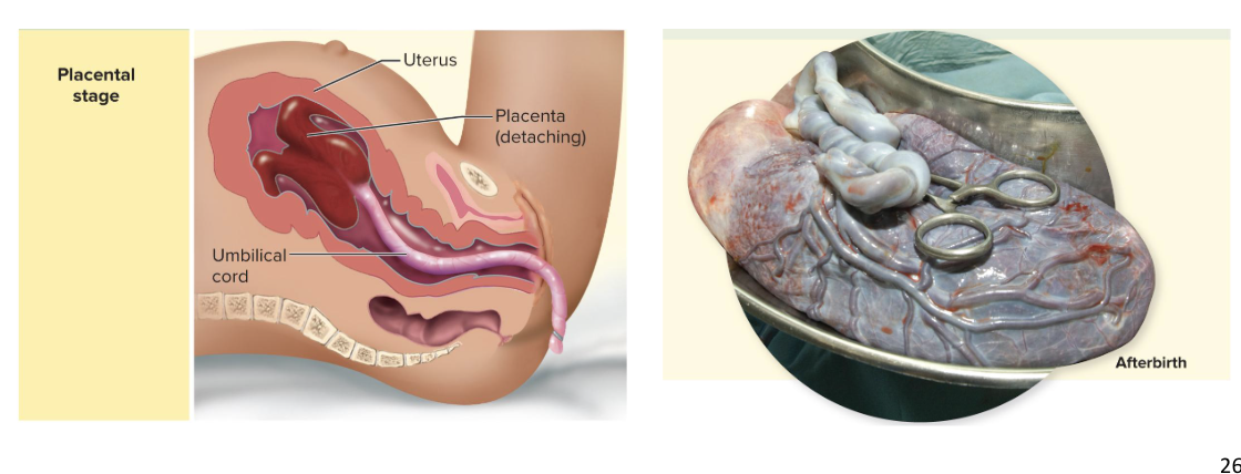 <p>uterine contractions cause placental separation and “delivery”</p><ul><li><p>Membranes (called the afterbirth) are inspected to make sure everything has been expelled</p></li></ul><p></p>