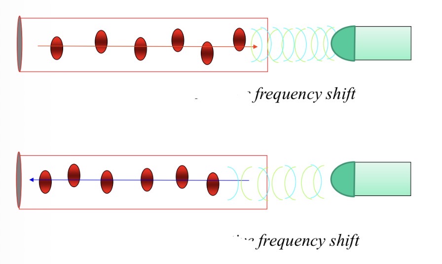 <p>Blood towards transducer → high frequency reflection → positive frequency shift </p>