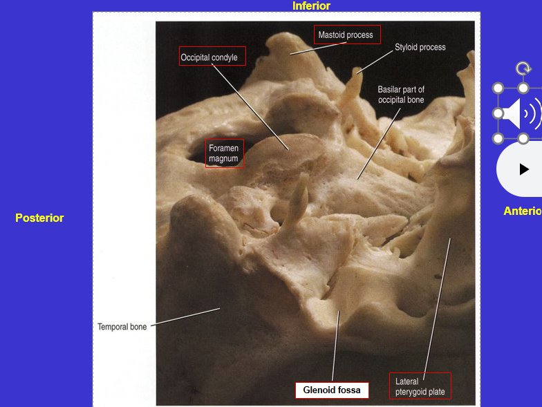 <p>Top = Zygomatic arches</p><p>Bottom = Pterygoid plates (medial to zygomatic arch)</p><p>sites of chewing muscle attachment</p>