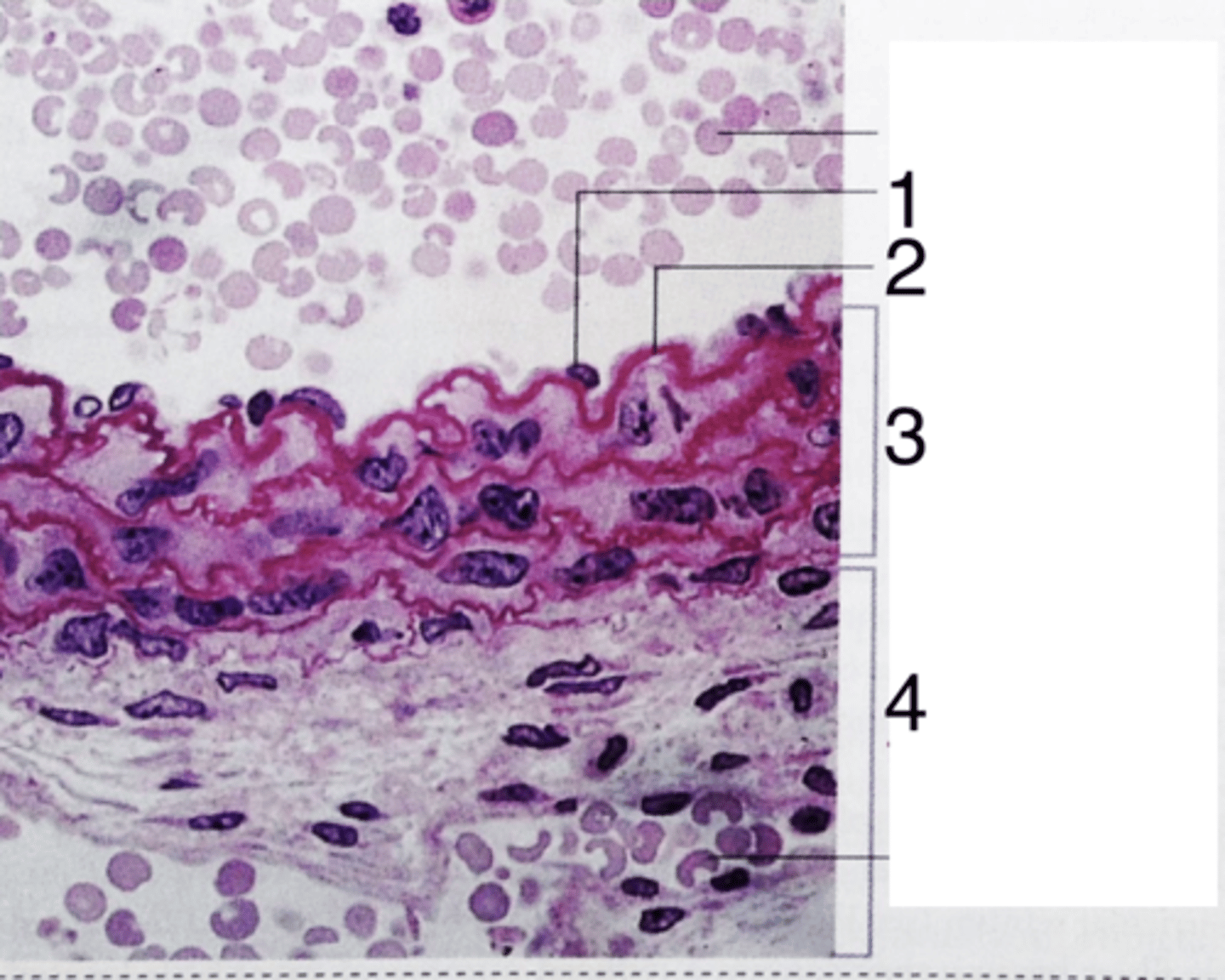 <p>what type of artery is this?</p>