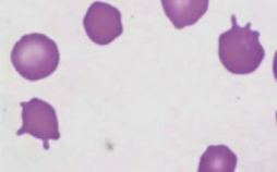 <p>RBC with projections of irregular number, size, and location</p>