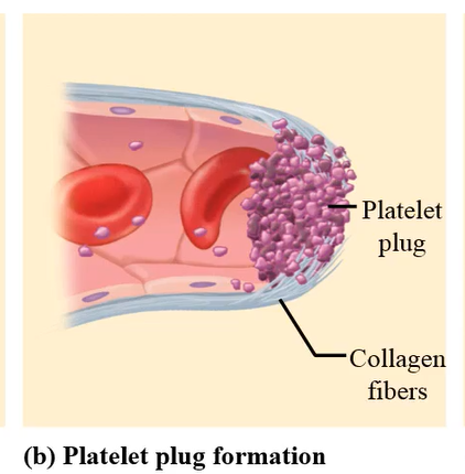<p>When platelets aggregate to form a platelet plug or a white thrombus (It is known as white thrombus because platelets are colorless cells)</p>