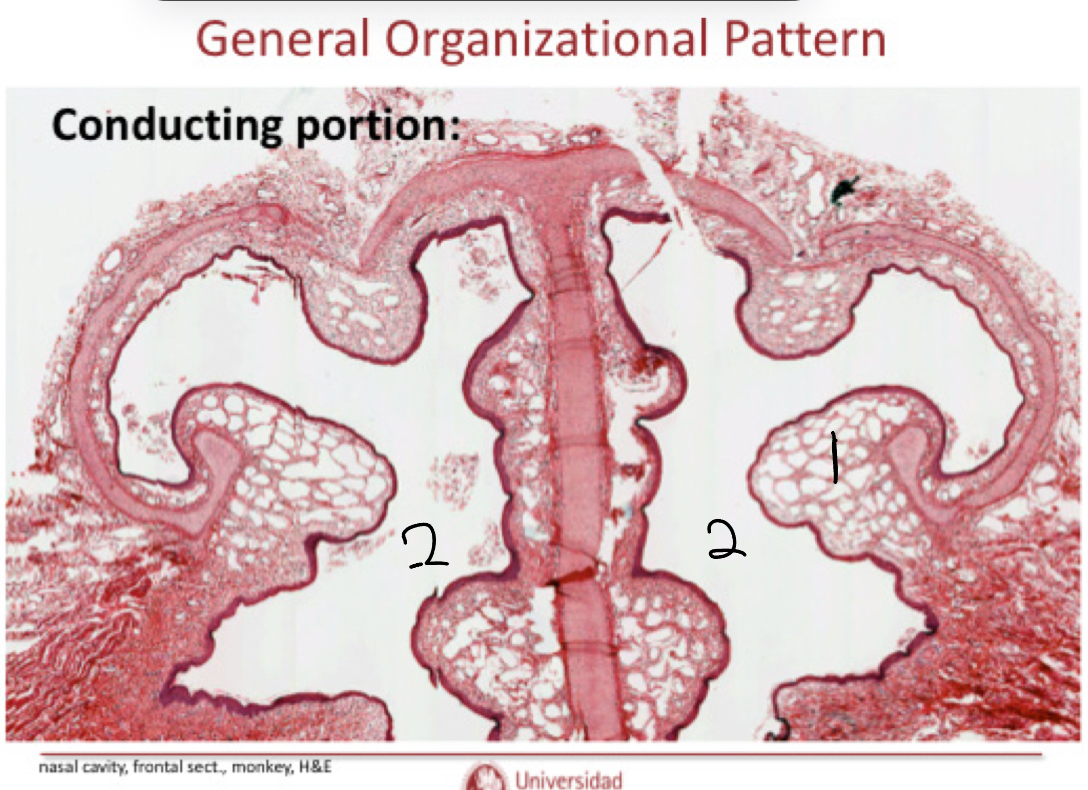 <p>Label the image and explain whee it is. Also, what type of epithelial cells does it have?</p>