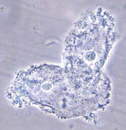 <p>Clue cells are: </p>