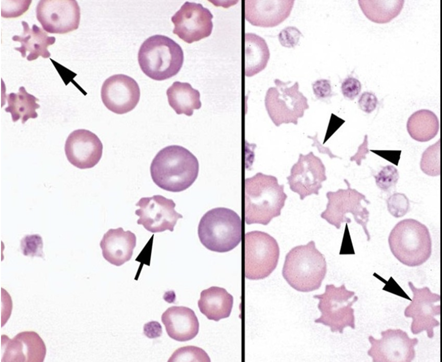 <p>The complete arrows ON THE LEFT image are pointing to</p>