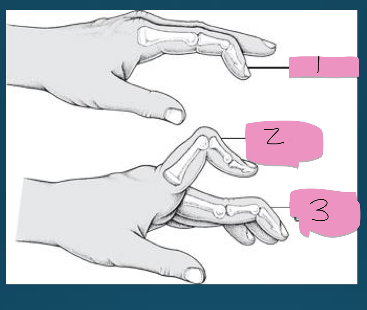 <p>what is the number 3 presentation called? </p><p>part of what diagnosis? </p>