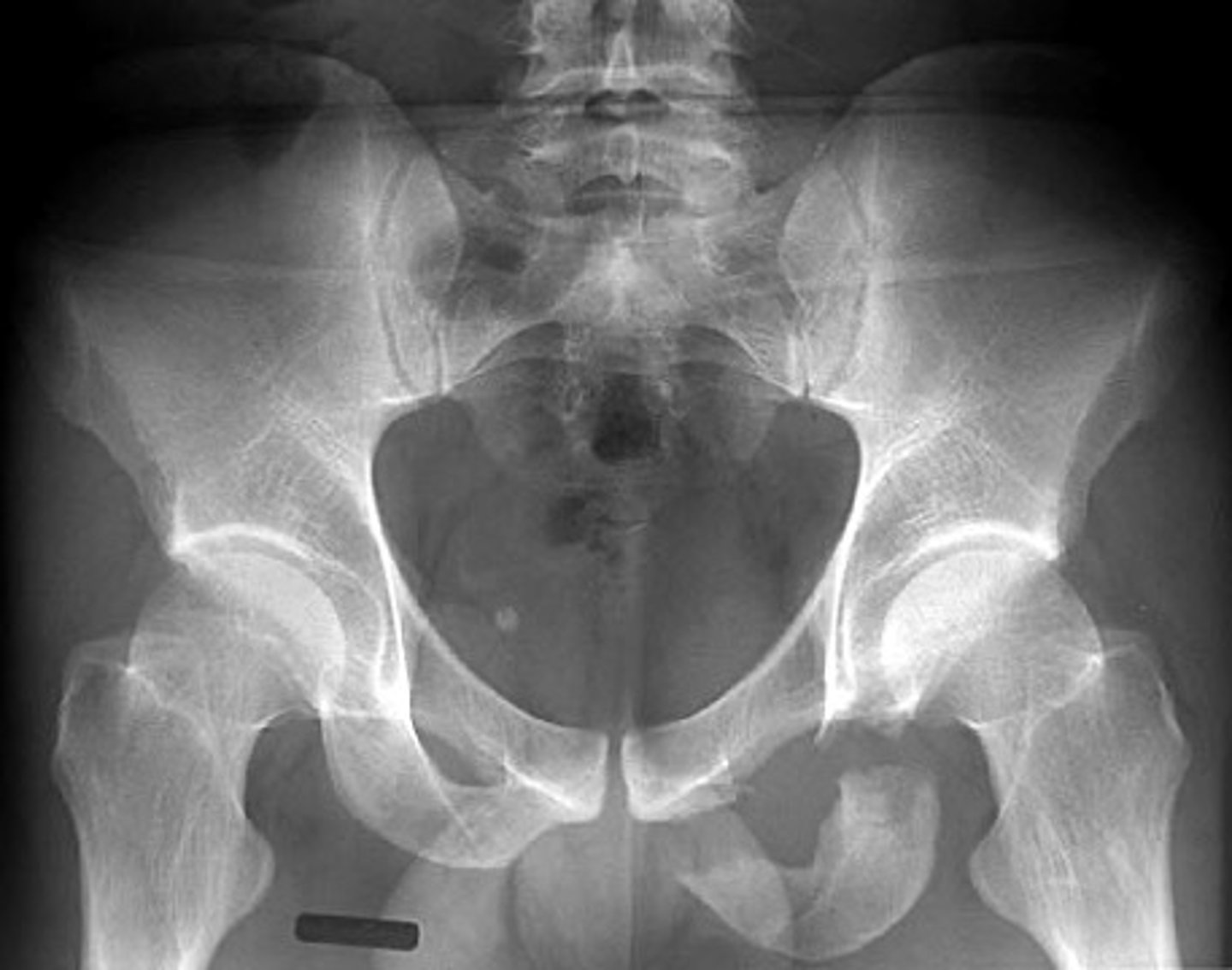 <p>What's going on here?</p>