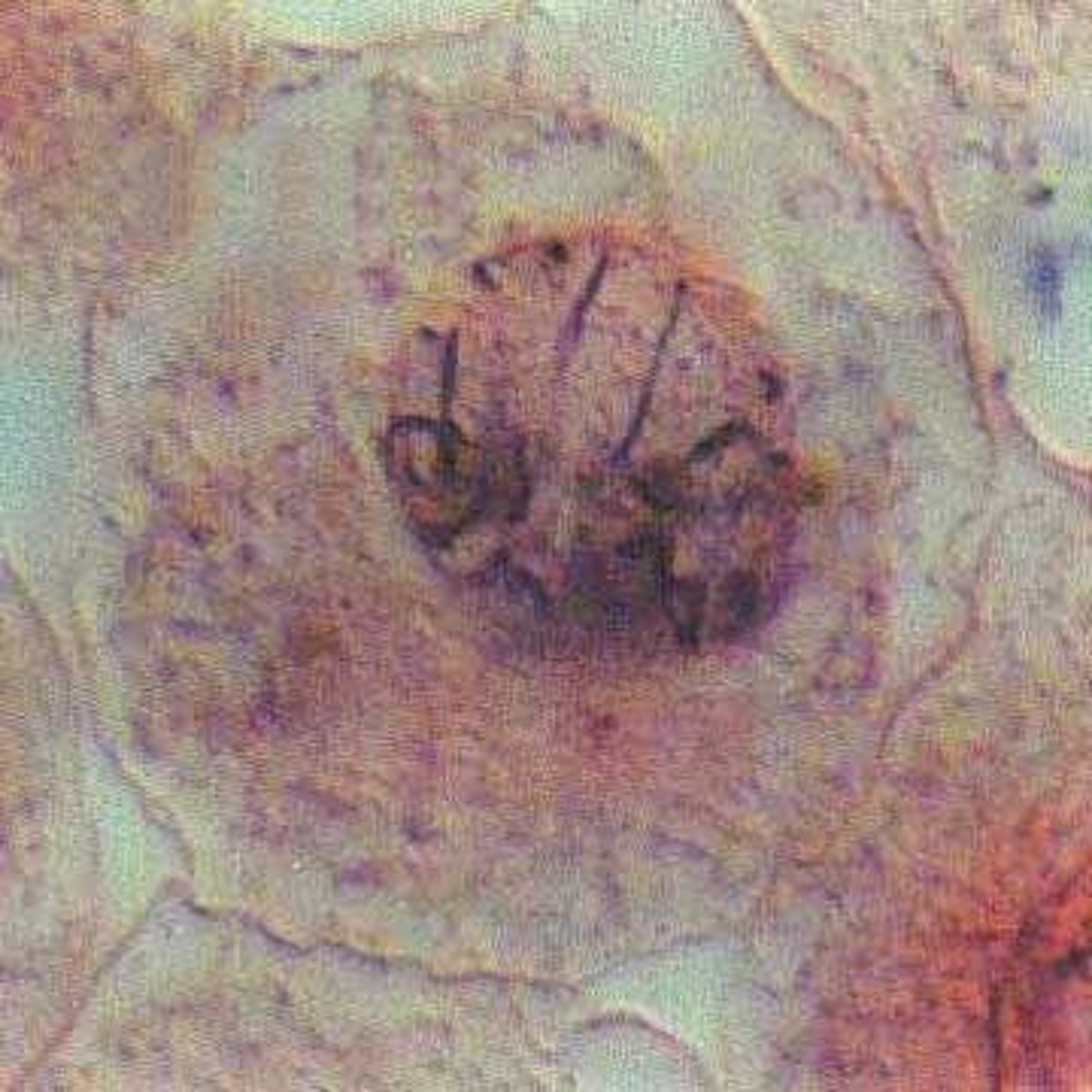 <p>Chromatin condenses, sister chromatids become visible, centrioles move to opposite poles, spindle forms, and the nuclear envelope disappears.</p>