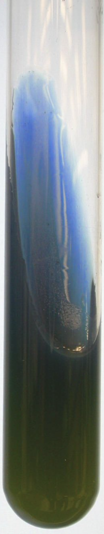 <p>Is this a positive or negative Simmon’s citrate agar?</p>