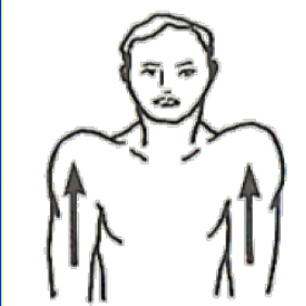 <p>What Movement is occurring?</p>