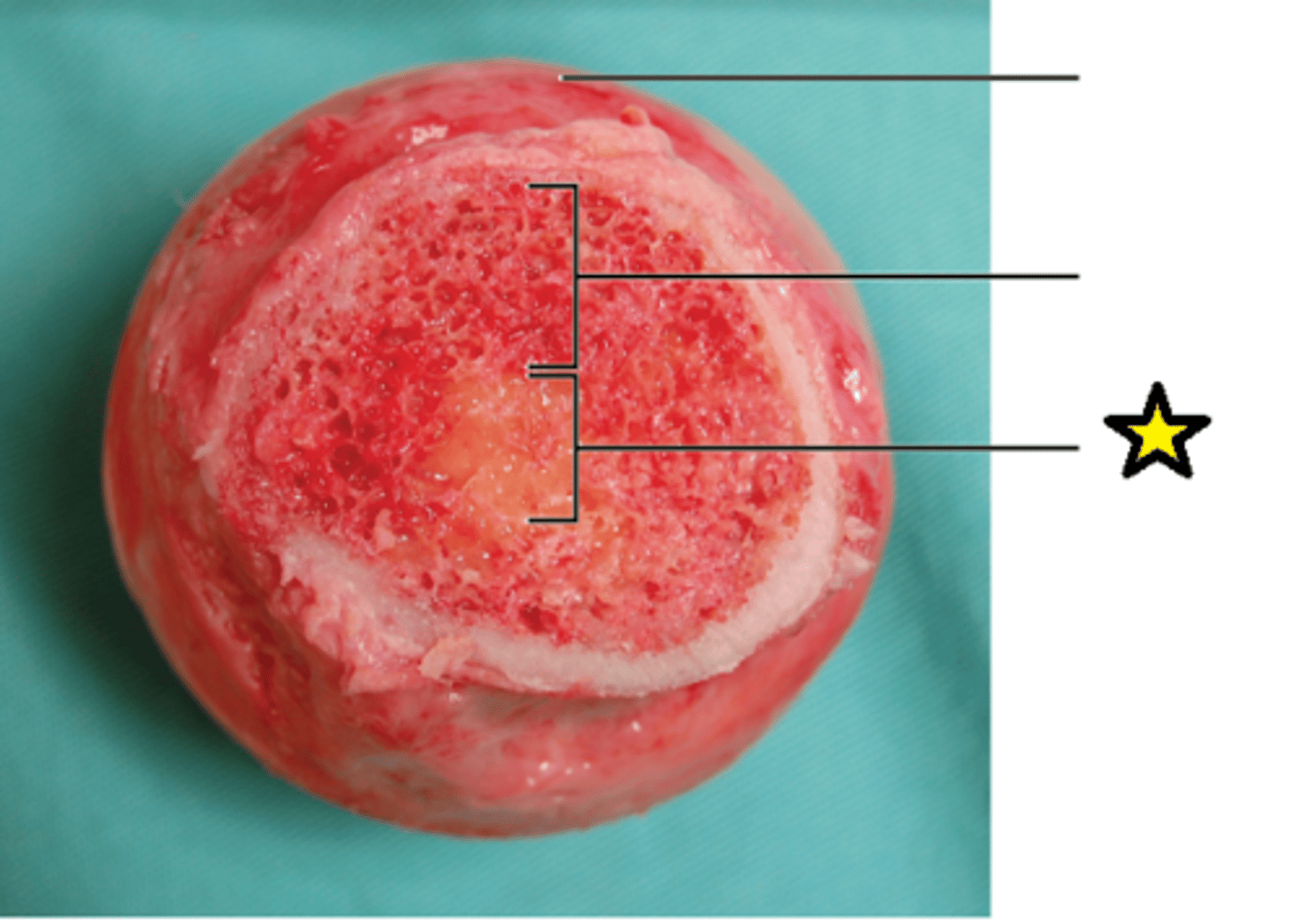 <p>Soft, fatty material found in the medullary cavity of long bones.</p>