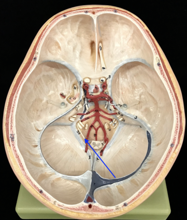 <p>What is the cranial nerve and roman numeral?</p>